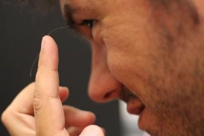Stuart Muller - pemilik bulu mata terpanjang di dunia